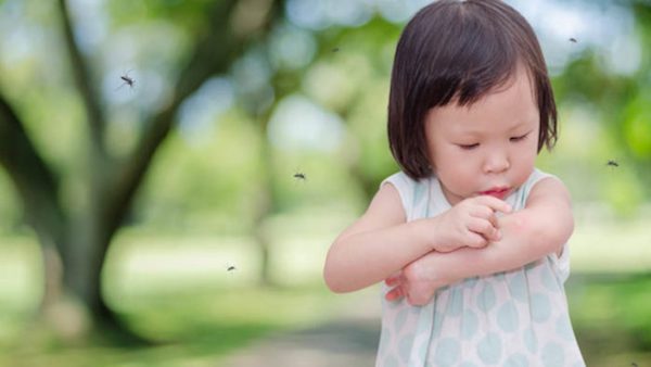 Top 7 thuốc bôi muỗi đốt cho bé an toàn, hiệu quả nhất