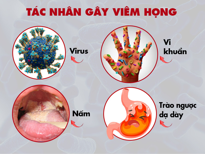 Tac-nhan-gay-viem-hong-31-05