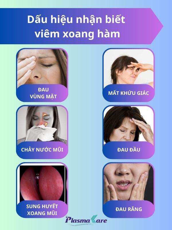 viem-xoang-ham-la-benh-gi-va-co-nguy-hiem-khong-3