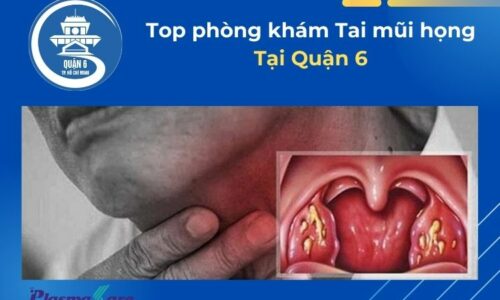tai-mui-hong-quan-6-1
