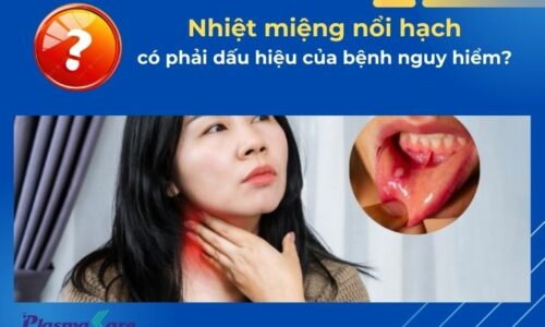 nhiet-mieng-noi-hach-1