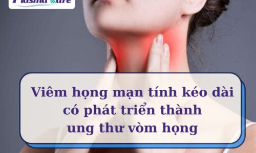 Ung thư vòm họng có phải biến chứng để lại của viêm họng hạt
