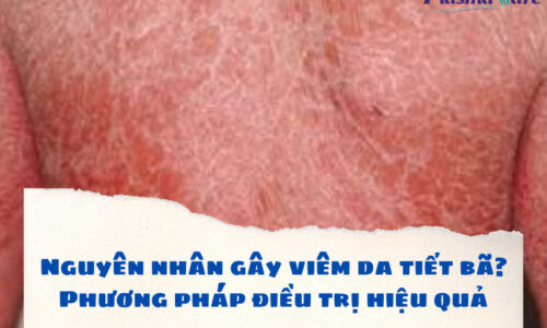 nguyen-nhan-gay-viem-da-tiet-ba_-phuong-phap-dieu-tri-hieu-qua-1
