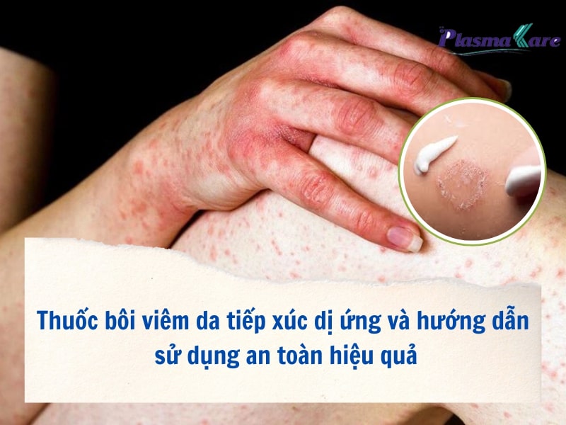 thuoc-boi-viem-da-tiep-xuc-di-ung-va-huong-dan-su-dung-an-toan-1