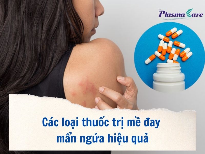 Triệu chứng của mẩn ngứa