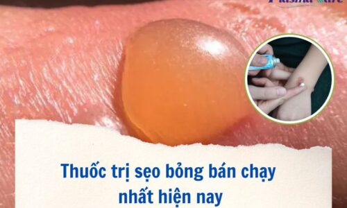 thuoc-tri-seo-bong-ban-chay-nhat-hien-nay