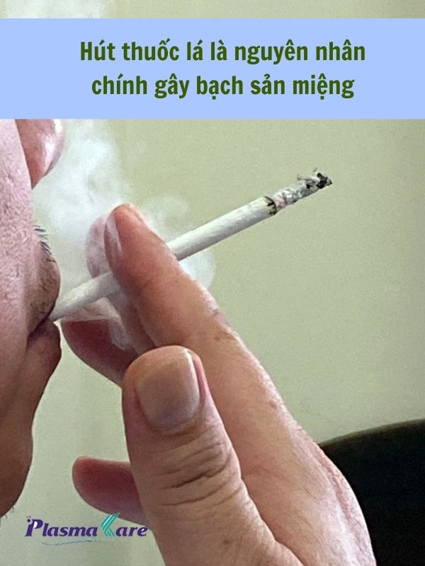 Hút thuốc lá là nguyên nhân chính gây bạch sản miệng