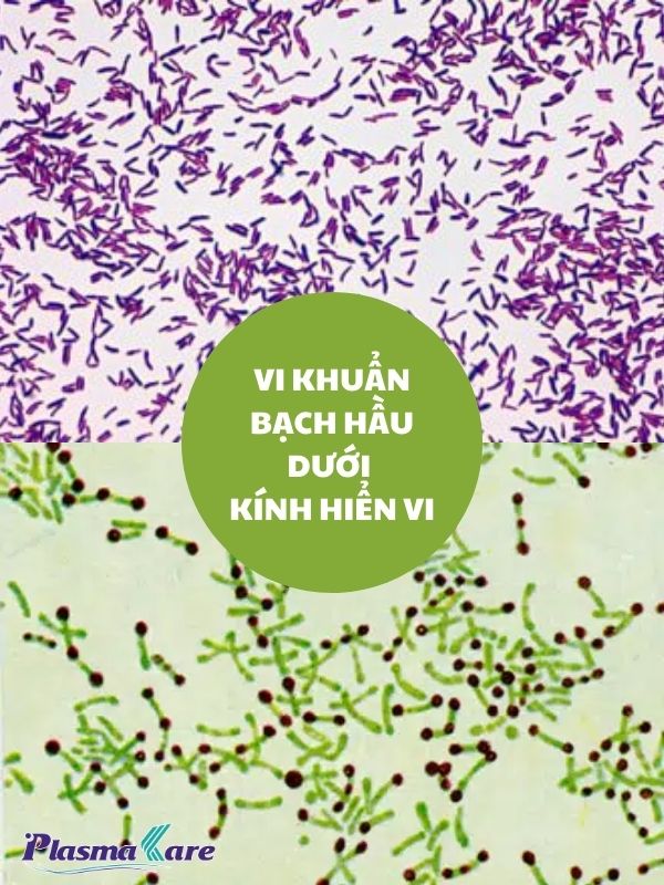 nano-bac-phuong-phap-hieu-qua-trong-dieu-tri-bach-hau-sau-phau-thuat-1