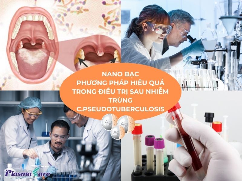 nano-bac-phuong-phap-hieu-qua-trong-dieu-tri-bach-hau-sau-phau-thuat-1