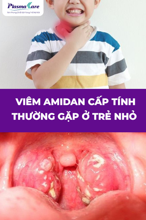 viem-amidan-cap-tinh-co-tu-khoi-duoc-khong-dau-hieu-va-cach-dieu-tri-hieu-qua-2