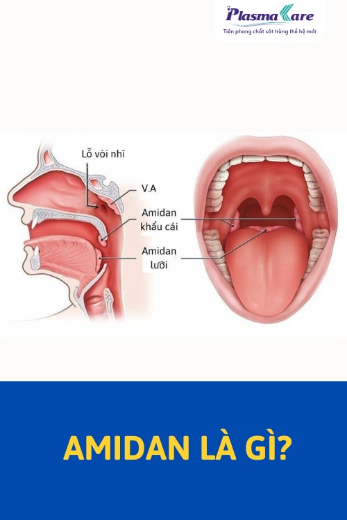 benh-viem-amidan-2