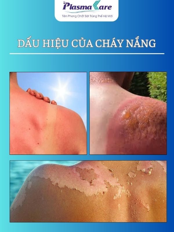 chua-bong-da-phong-rop-nhanh-chong-khong-de-lai-seo-voi-gel-plasmakare-no5-2