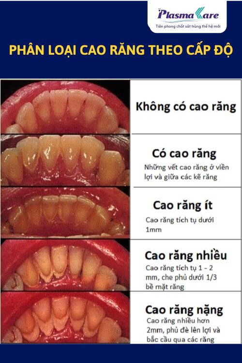 cao-rang-co-gay-hoi-mieng-khong-2