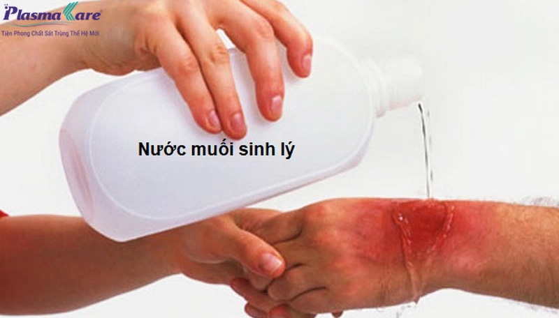 nuoc-muoi-sinh-ly-suc-mieng-5