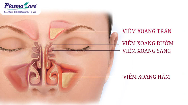 dau-hieu-cua-viem-xoang-2