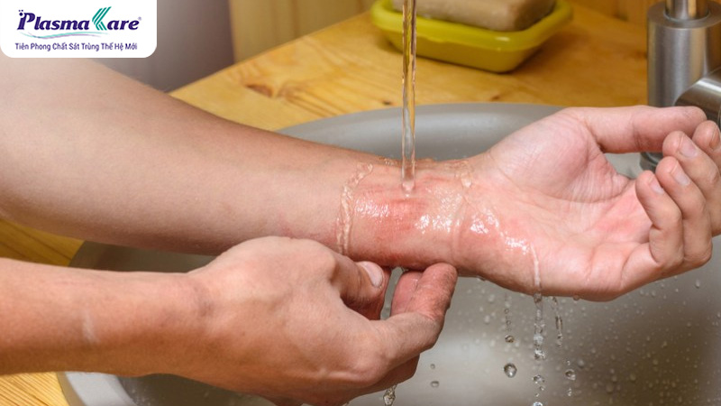 Rửa sạch ngay lập tức