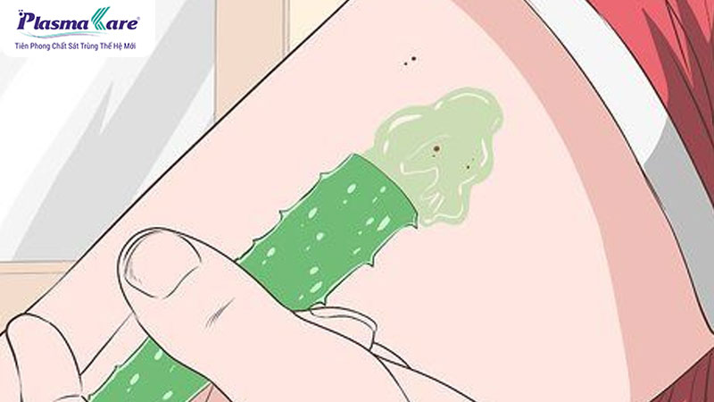 Cách hết ngứa khi bị muỗi đốt hiệu quả nhanh nhất