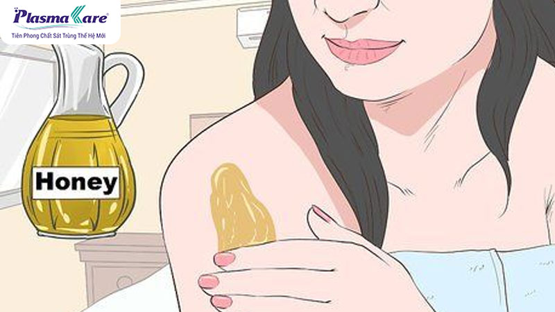 Cách hết ngứa khi bị muỗi đốt hiệu quả nhanh nhất