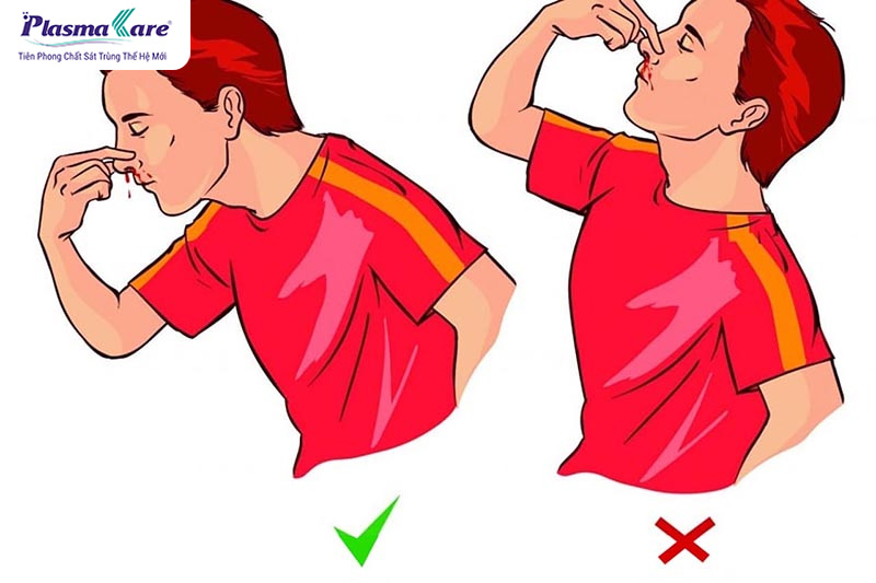 Nguyên nhân hắt xì, hỉ mũi ra máu và cách điều trị dứt điểm