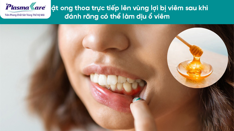 Hình ảnh viêm lợi trùm răng số 8: cách chữa trị bằng thuốc và dân gian