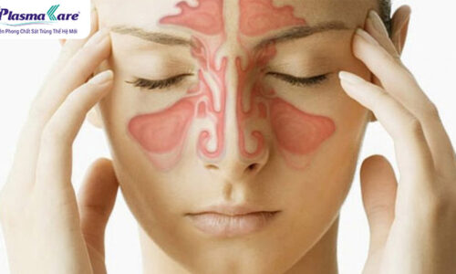 Bị viêm xoang nên kiêng gì và nên ăn gì? Những lưu ý quan trọng