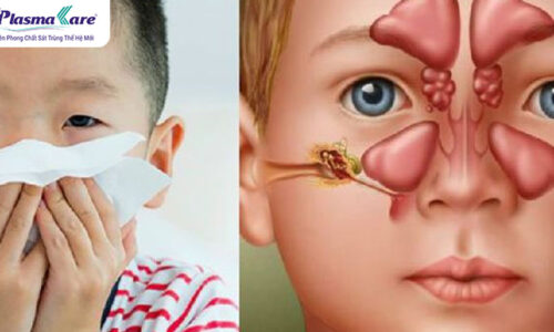 Bé chảy nước mũi xanh đặc: nguyên nhân và cách điều trị
