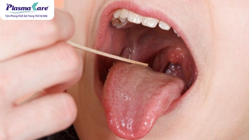 Bé chảy nước mũi xanh đặc: nguyên nhân và cách điều trị