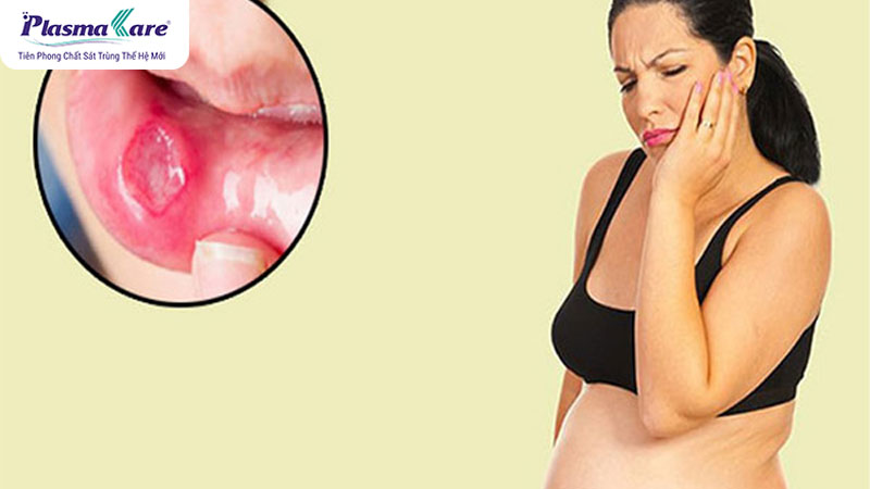 Bà bầu và trẻ bị nhiệt miệng uống gì an toàn và hiệu quả nhanh?