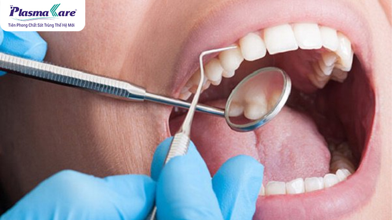 Có nên lấy cao răng thường xuyên không? Mấy tháng 1 lần?