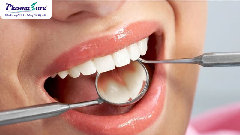 Review chi tiết về các dụng cụ lấy cao răng tại nhà