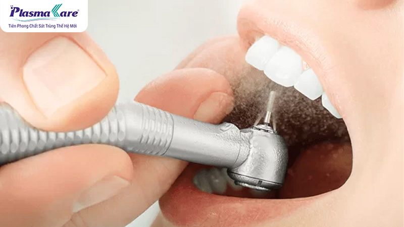 Lấy cao răng có đau không? Cần lưu ý gì?