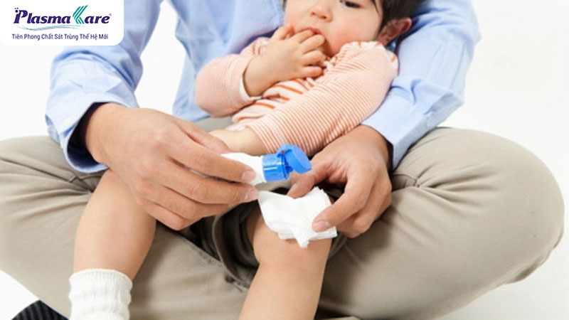 Mách mẹ cách điều trị và chăm sóc bé bị phỏng bô xe máy