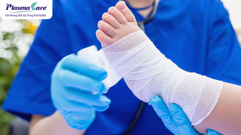 Mách mẹ cách điều trị và chăm sóc bé bị phỏng bô xe máy