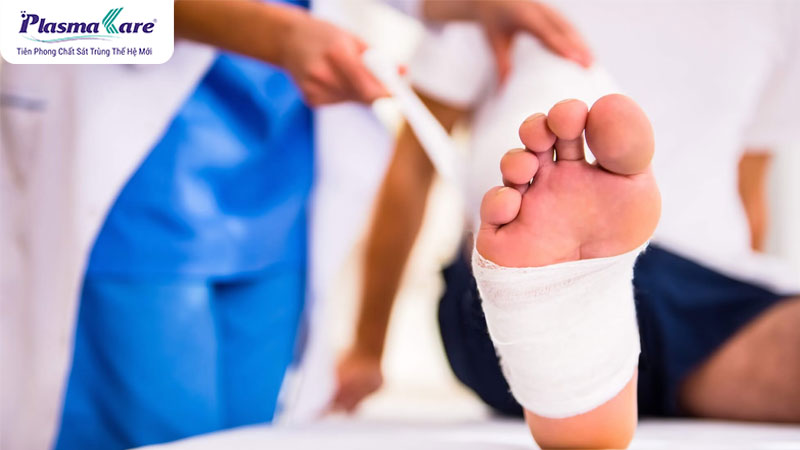 Bị bỏng bô có để lại sẹo không? Mách bạn cách điều trị hiệu quả nhất