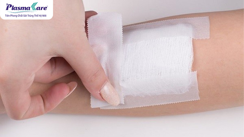 Cách xử lý bỏng bô xe máy bị phồng nước, vỡ và chảy nước vàng