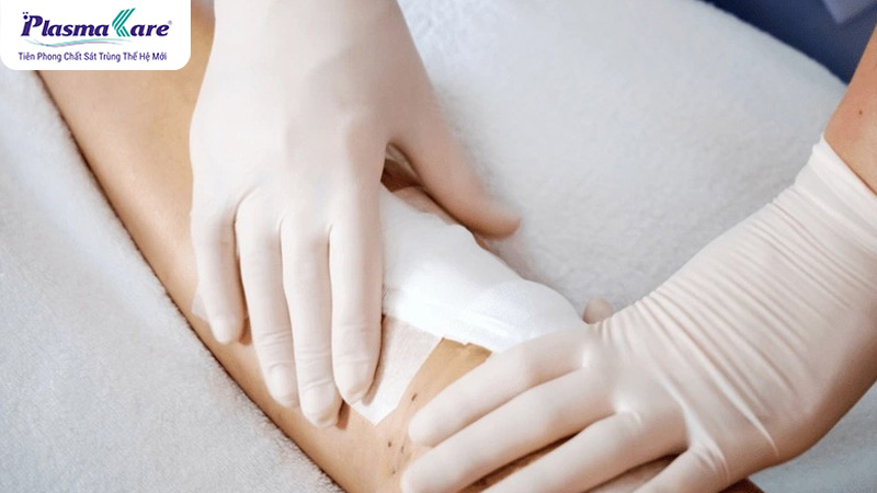 Cách xử lý bỏng bô xe máy bị phồng nước, vỡ và chảy nước vàng