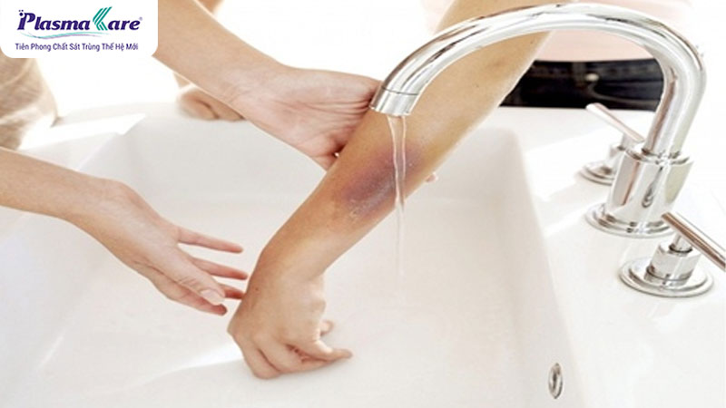 Sử dụng tia laser để tác động vào mô sẹo