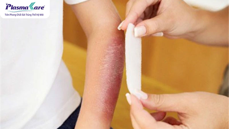 Sử dụng tia laser để tác động vào mô sẹo