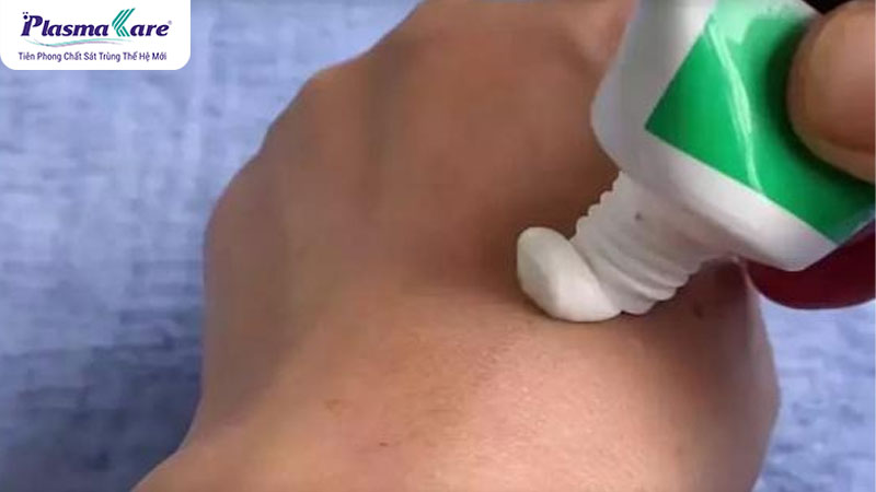 Điểm danh TOP 6 loại thuốc trị bỏng bô xe máy tốt nhất hiện nay