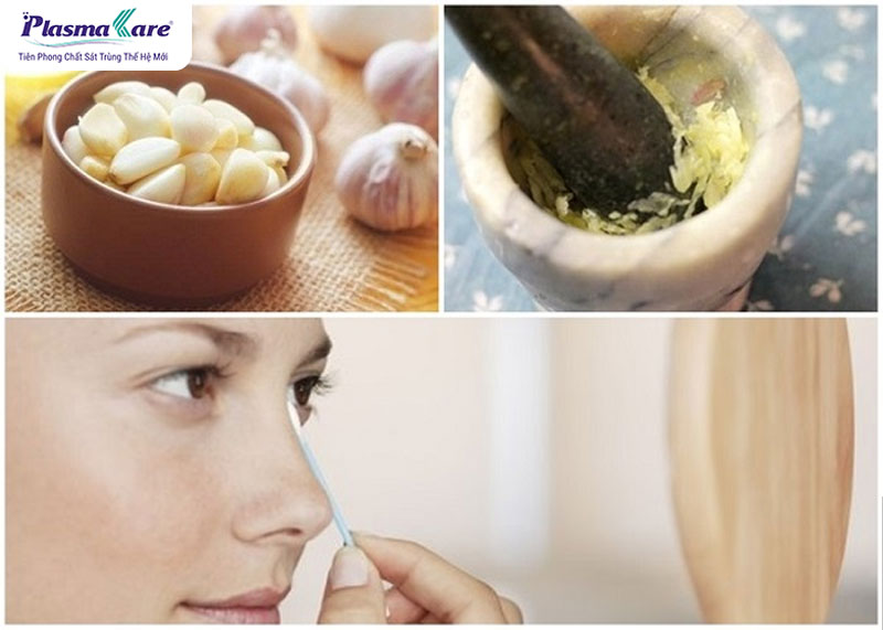 Bỏng tỏi: Nguyên nhân, triệu chứng và cách điều trị hiệu quả