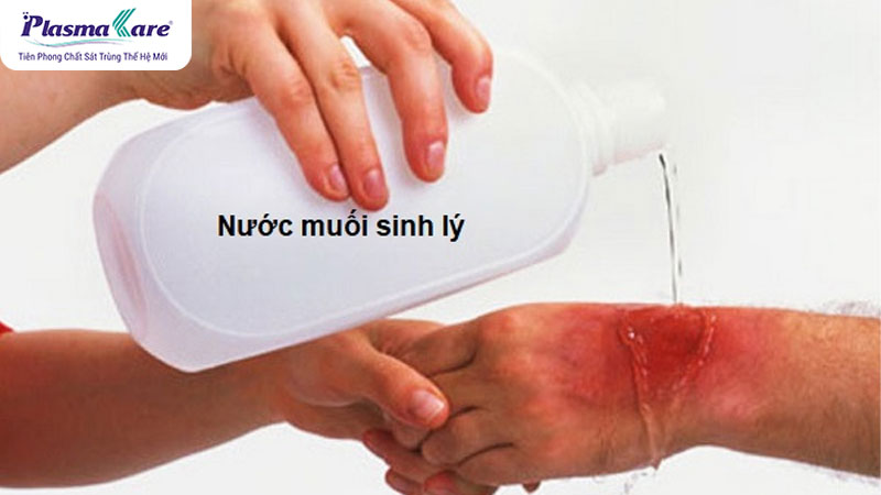 Vết bỏng bị thâm đen phải làm sao? Nên bôi gì để không bị sẹo?