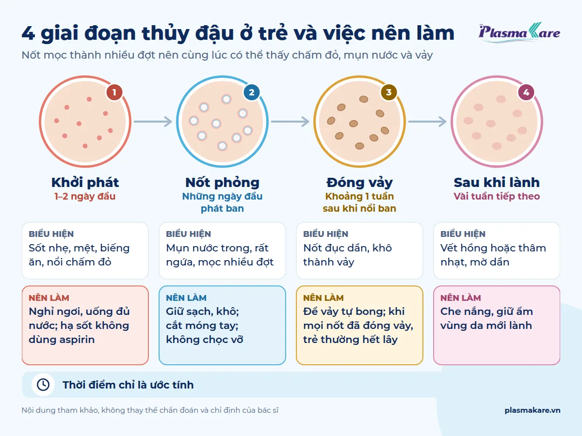 Infographic bốn giai đoạn thủy đậu ở trẻ: khởi phát, nốt phỏng, đóng vảy, sau khi lành và việc nên làm