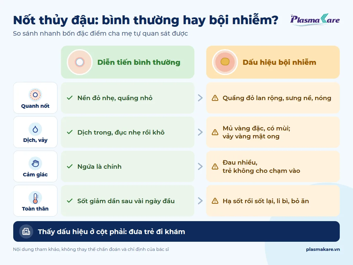 Infographic so sánh nốt thủy đậu diễn tiến bình thường và dấu hiệu bội nhiễm: quanh nốt, dịch vảy, cảm giác, toàn thân