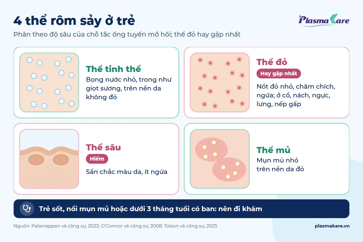 Infographic 4 thể rôm sảy ở trẻ: thể tinh thể, thể đỏ, thể sâu và thể mủ, kèm đặc điểm nhận biết