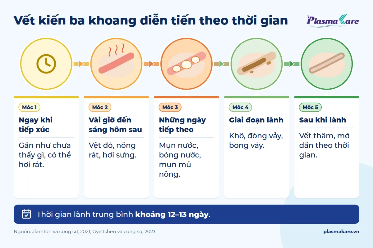 Infographic diễn tiến vết kiến ba khoang từ lúc tiếp xúc, đỏ rát, phồng rộp, đóng vảy đến khi lành để lại vết thâm