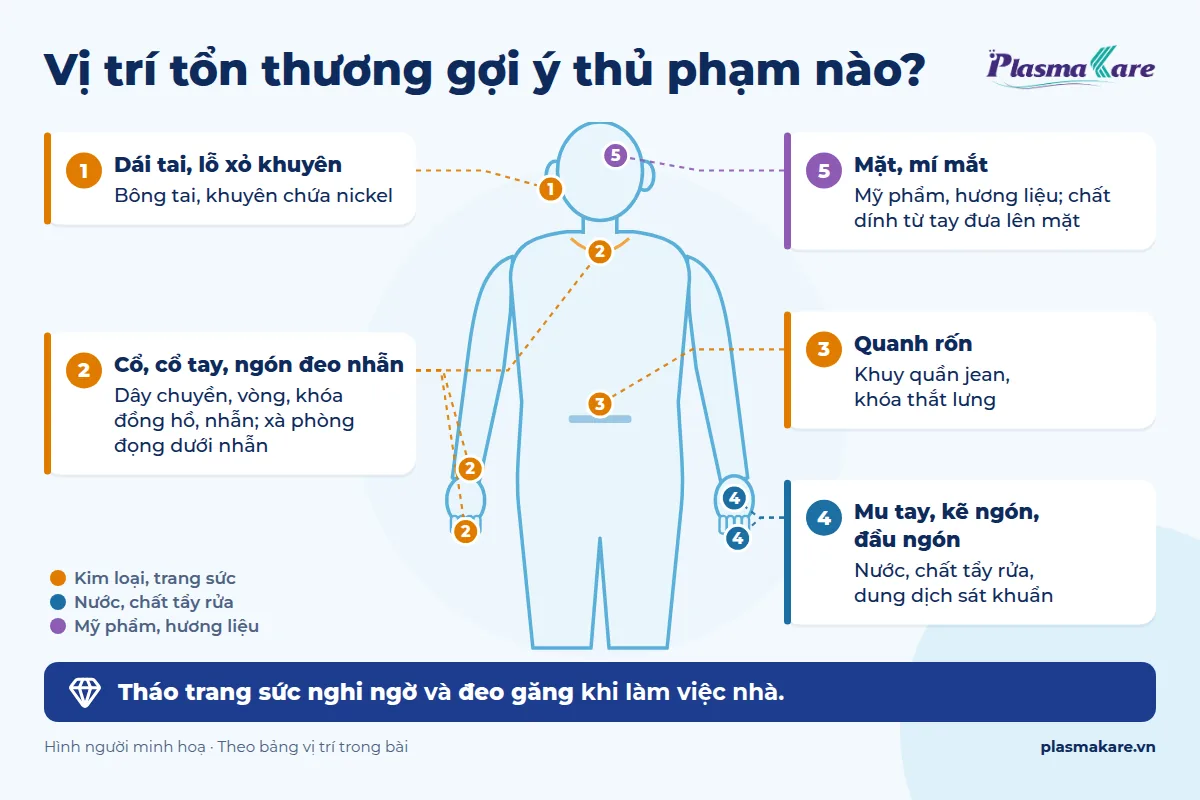Infographic vị trí viêm da tiếp xúc trên cơ thể và thủ phạm gợi ý: dái tai, cổ tay, ngón đeo nhẫn, quanh rốn, mu tay, mặt