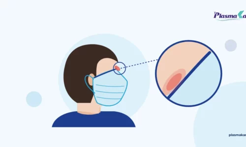 Vết hằn đỏ ở sống mũi do đeo khẩu trang lâu