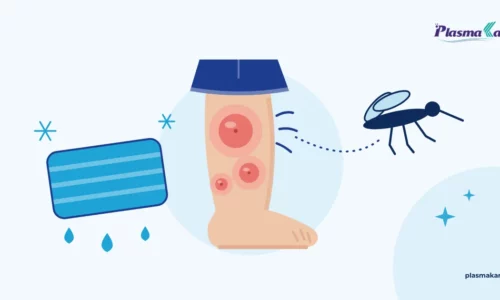 Vết muỗi đốt sưng đỏ ở cẳng chân trẻ nhỏ