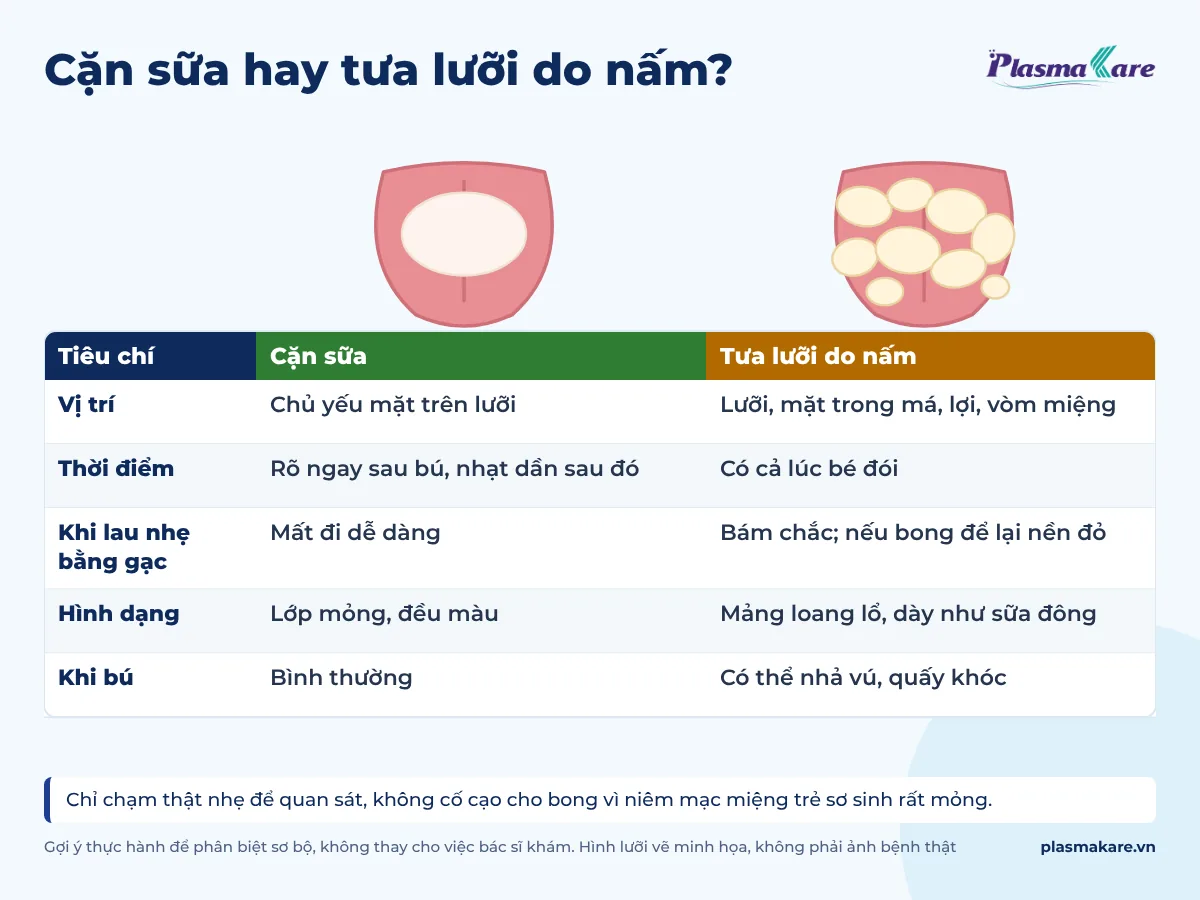 So sánh cặn sữa và tưa lưỡi do nấm theo năm tiêu chí, kèm hai hình lưỡi vẽ minh họa