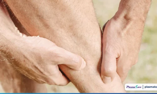 Vết muỗi đốt bị thâm lâu ngày có mờ đi được không? Vết muỗi đốt bị thâm lâu ngày có mờ đi được không?